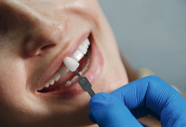 Dental Implants