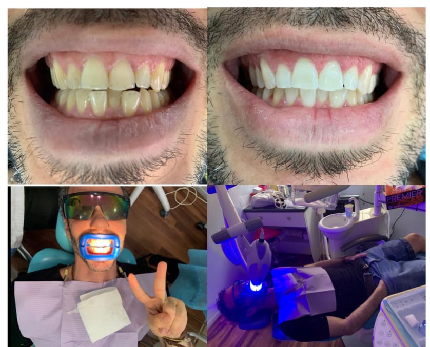 Teeths